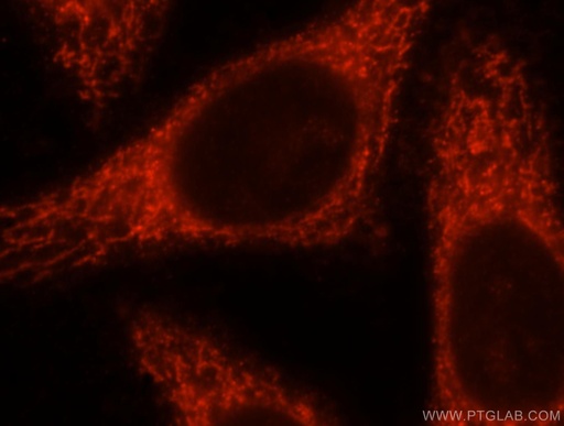 [16652-1-AP-20UL] MRPL10 Polyclonal antibody
