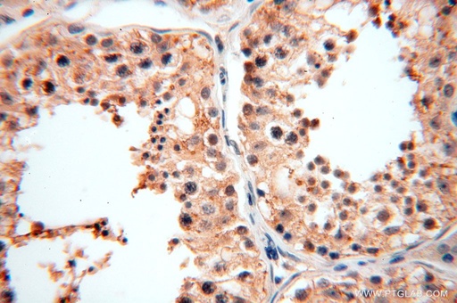 [16656-1-AP-150UL] SPATA19 Polyclonal antibody