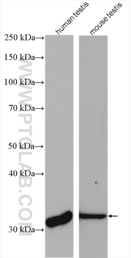 [16657-1-AP-150UL] PRPS1L1 Polyclonal antibody
