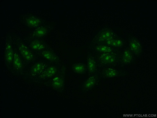 [16660-1-AP-20UL] DDX52 Polyclonal antibody