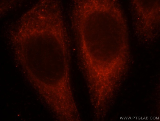 [16661-1-AP-150UL] UGT2B7 Polyclonal antibody