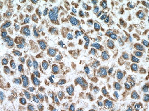 [16662-1-AP-150UL] PPA2 Polyclonal antibody