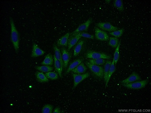 [16664-1-AP-150UL] AMZ2 Polyclonal antibody
