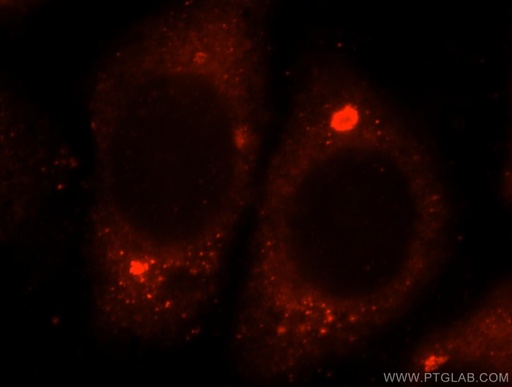 [16666-1-AP-20UL] GTDC1 Polyclonal antibody