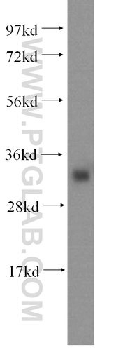 [16667-1-AP-20UL] IYD Polyclonal antibody