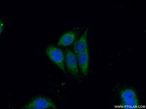 [16668-1-AP-20UL] CD40L/CD154 Polyclonal antibody
