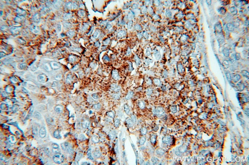 [16673-1-AP-20UL] HPSE Polyclonal antibody