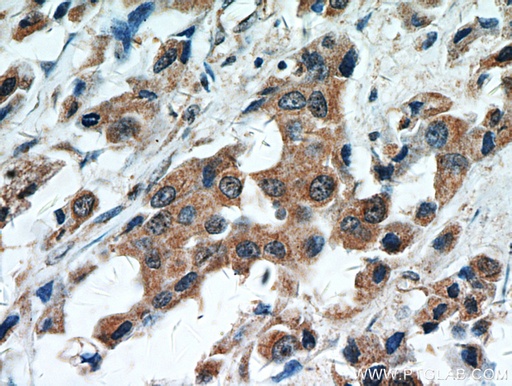 [16674-1-AP-20UL] STAT2 Polyclonal antibody