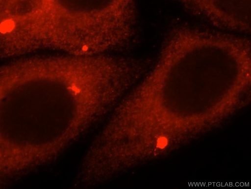 [16675-1-AP-20UL] AMFR Polyclonal antibody