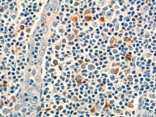 [16677-1-AP-150UL] CD244 Polyclonal antibody