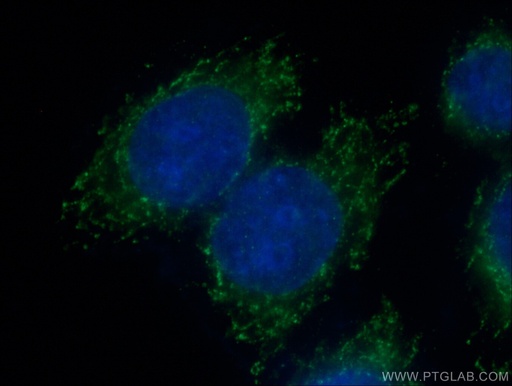 [16680-1-AP-20UL] RPS13 Polyclonal antibody