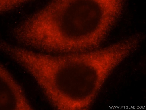 [16681-1-AP-20UL] RPL10A Polyclonal antibody