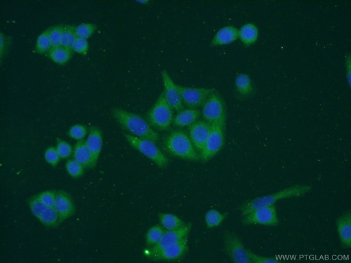 [16684-1-AP-150UL] DCTPP1 Polyclonal antibody