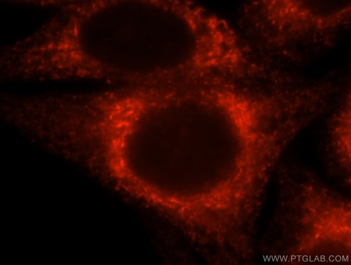 [16686-1-AP-20UL] CKAP4 Polyclonal antibody