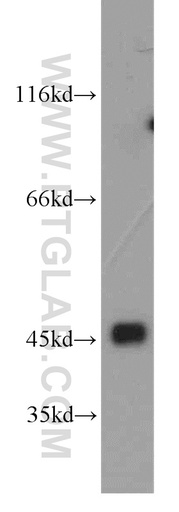 [16687-1-AP-150UL] Cytohesin 3 Polyclonal antibody