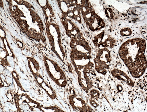 [16689-1-AP-150UL] TOMM6 Polyclonal antibody