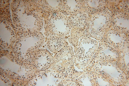 [16692-1-AP-150UL] PARP11 Polyclonal antibody