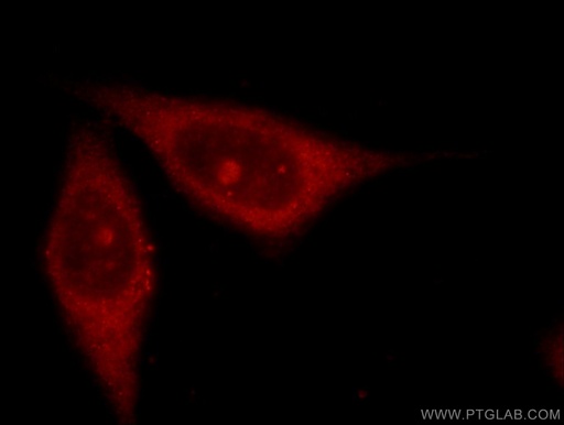[16697-1-AP-150UL] ARHGAP4 Polyclonal antibody