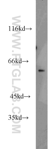 [16699-1-AP-150UL] NKD2 Polyclonal antibody