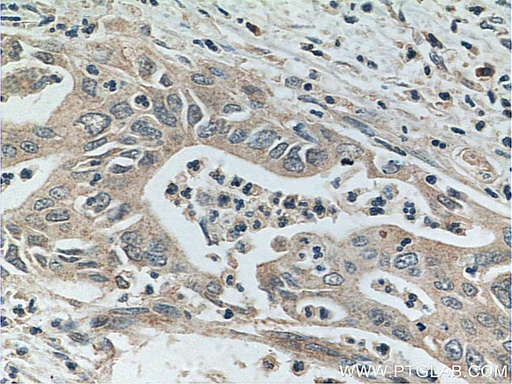[16700-1-AP-20UL] Glypican 1 Polyclonal antibody