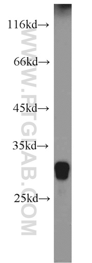 [16701-1-AP-20UL] IDI2 Polyclonal antibody