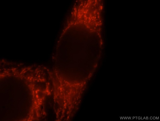 [16703-1-AP-150UL] GSTA3 Polyclonal antibody