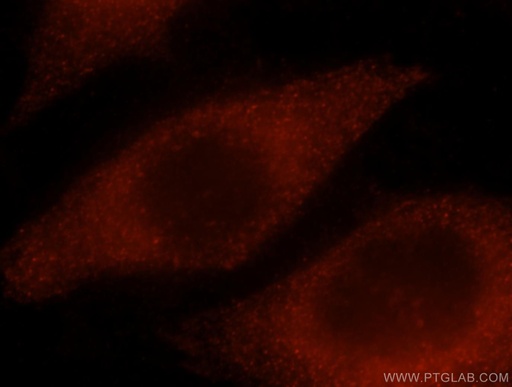 [16715-1-AP-150UL] NPL Polyclonal antibody
