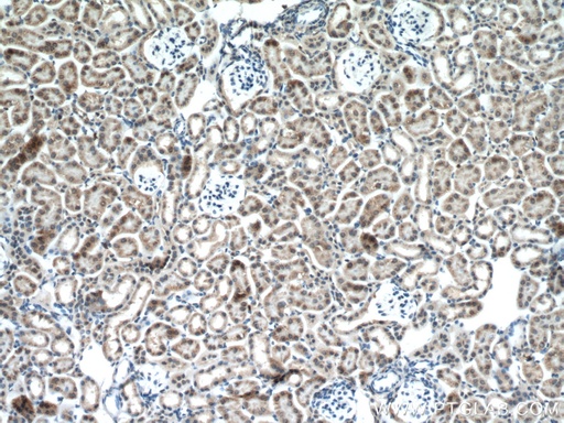 [16716-1-AP-20UL] GALNT3 Polyclonal antibody