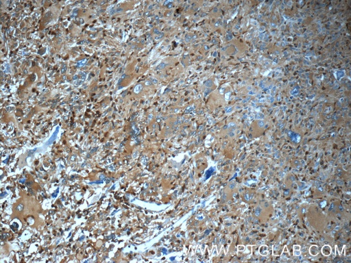 [16717-1-AP-150UL] ARPC5 Polyclonal antibody