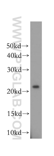 [16719-1-AP-150UL] OBFC2A Polyclonal antibody