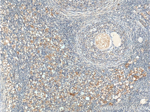 [16723-1-AP-150UL] ANTXR2 Polyclonal antibody