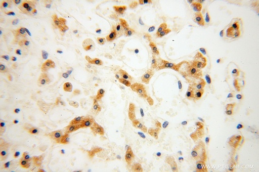 [16724-1-AP-20UL] CPOX Polyclonal antibody