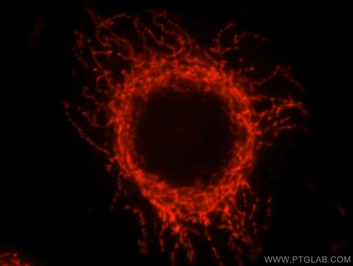 [16726-1-AP-150UL] GCSH Polyclonal antibody