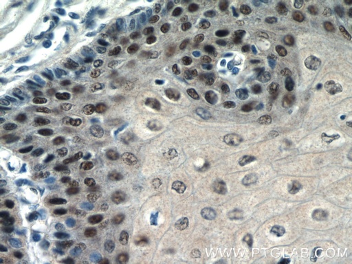 [16727-1-AP-20UL] TRMT6 Polyclonal antibody