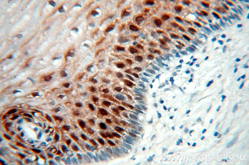 [16730-1-AP-150UL] Galectin-7 Polyclonal antibody