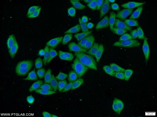 [16731-1-AP-20UL] EXOSC10 Polyclonal antibody