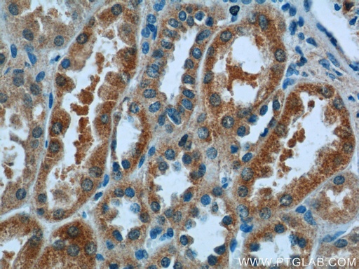 [16733-1-AP-150UL] N4BP3 Polyclonal antibody