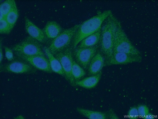 [16735-1-AP-150UL] MRPS16 Polyclonal antibody