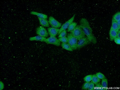 [16739-1-AP-20UL] TASP1 Polyclonal antibody