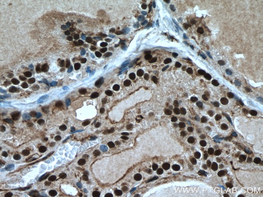 [16741-1-AP-150UL] TBX3 Polyclonal antibody