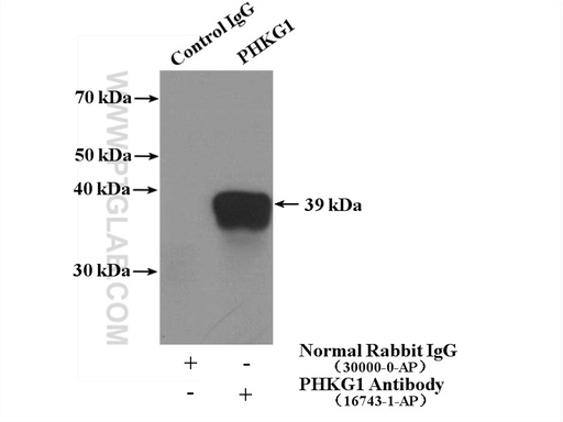 [16743-1-AP-150UL] PHKG1 Polyclonal antibody