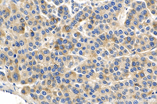 [16744-1-AP-150UL] IL-15RA Polyclonal antibody