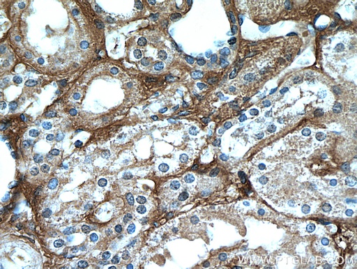 [16747-1-AP-20UL] Fibrinogen Beta Chain Polyclonal antibody