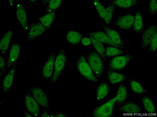 [16750-1-AP-20UL] SPOP Polyclonal antibody