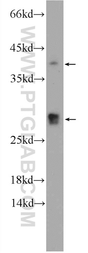 [16751-1-AP-150UL] CENPN Polyclonal antibody