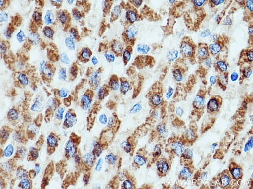[16752-1-AP-20UL] HSD17B8 Polyclonal antibody