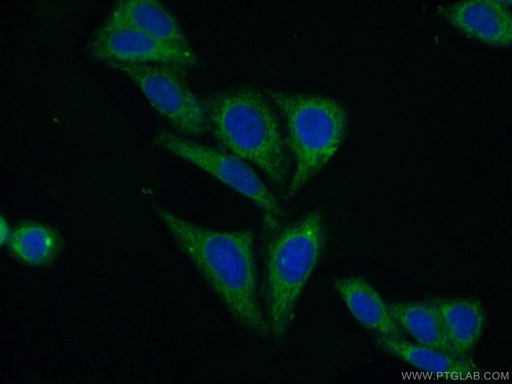 [16754-1-AP-150UL] PCK1 Polyclonal antibody