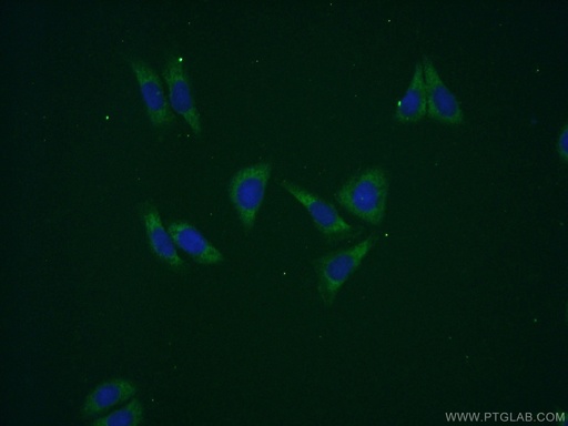[16757-1-AP-20UL] GPT2 Polyclonal antibody
