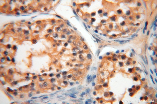 [16762-1-AP-150UL] AGPAT6 Polyclonal antibody