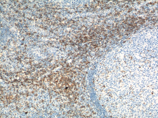 [16763-1-AP-20UL] CD6 Polyclonal antibody